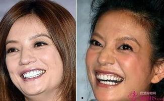 明星的法令纹操,轻松告别法令纹，焕发青春光彩